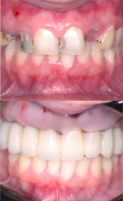 Before and after 2