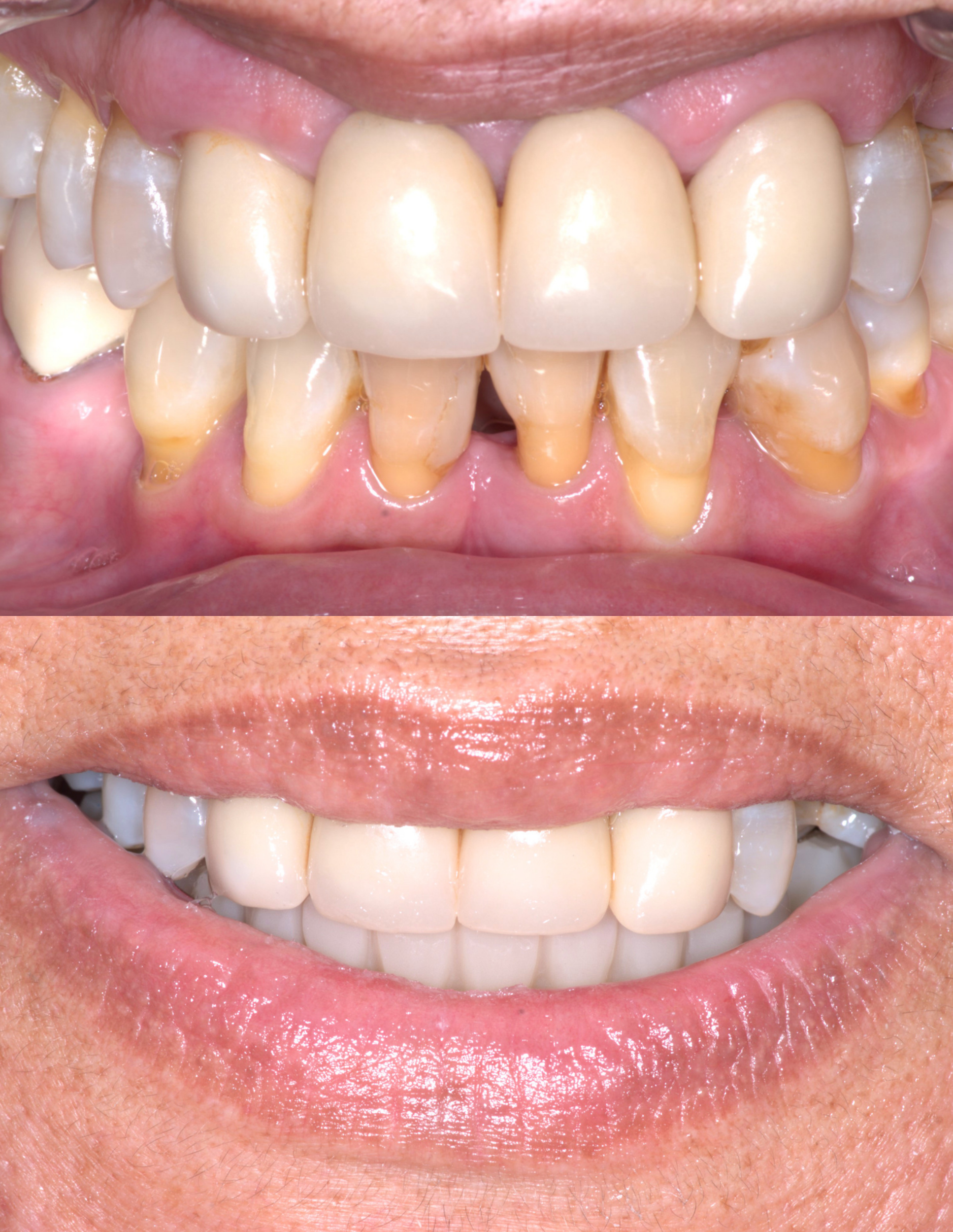 Before and after 6